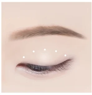 자연유착 쌍꺼풀 2단계 — 미세 구멍