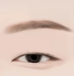 비절개 눈매교정 1단계 — 눈매 디자인