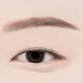 안검하수 단계 — 중증도의 하수