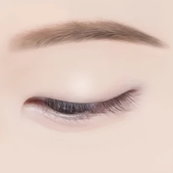 눈밑지방재배치 6단계 — 교정 완료