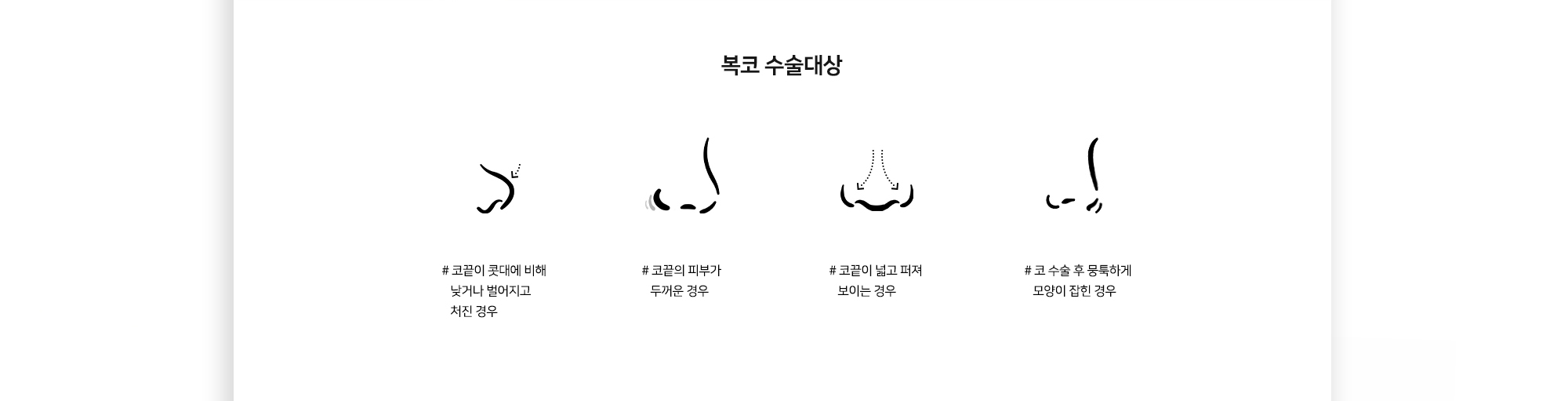 복코 수술대상