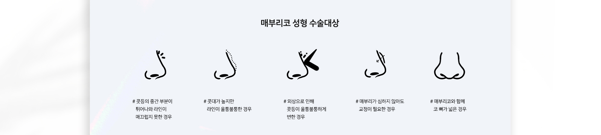 매부리코 성형 수술대상