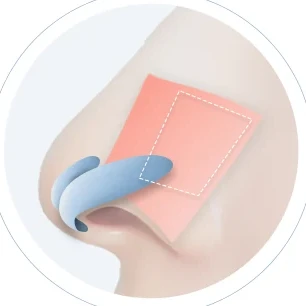 연골 배치 디자인