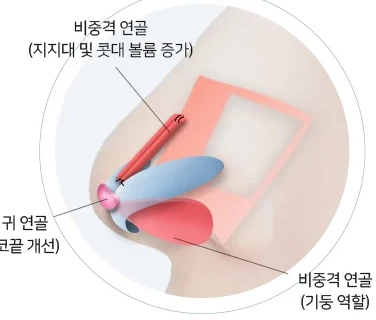 귀 연골과 비중격 연골을 이용한 교정