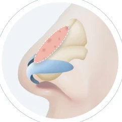진피 디자인