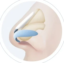 최종삽입