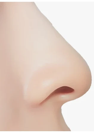 짧은코 성형 수술 후