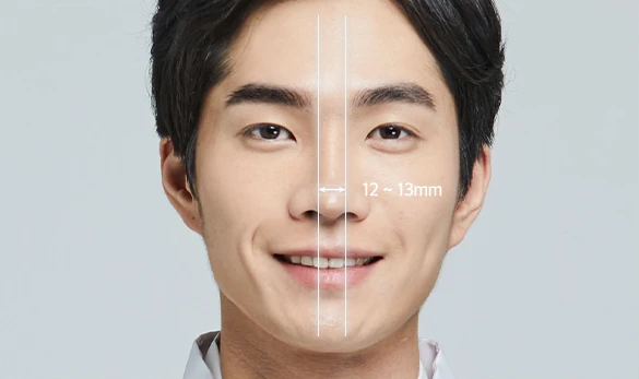 남자코성형 정면 기준 — 콧대 폭 12~13mm