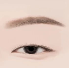 눈썹하거상 수술방법 01 디자인