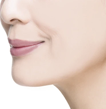 실리프팅 시술 방법 03 — 당김·소독