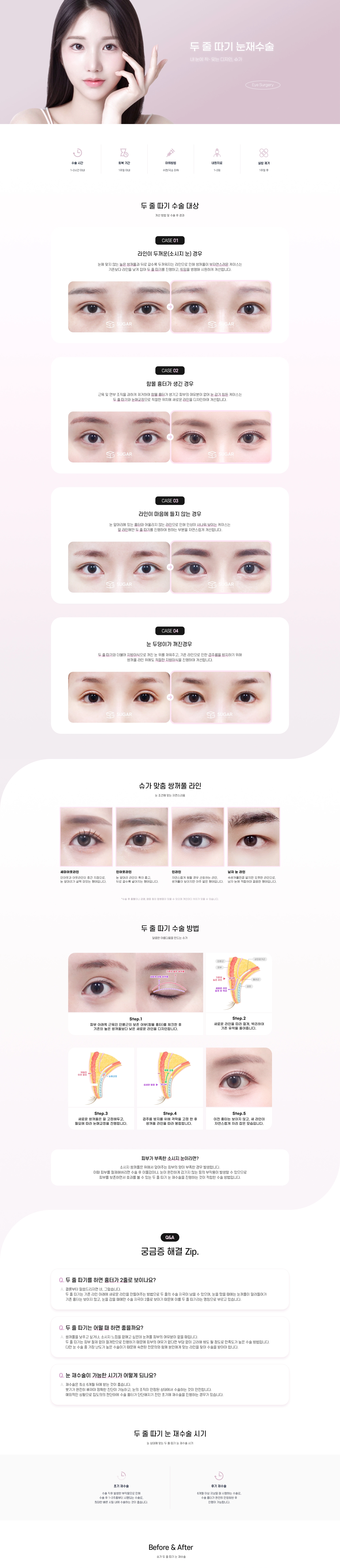달콤한 아름다움 슈가성형외과